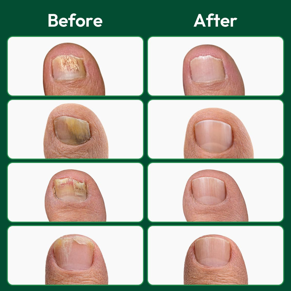 VERDORA hand holding patch to show size and easy application benefit