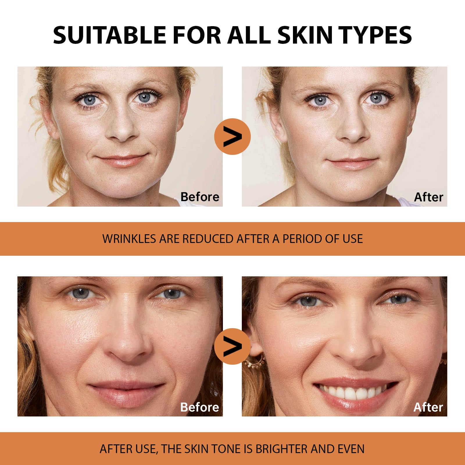 VGO ingredient list label showing vitamin C, hyaluronic acid benefits