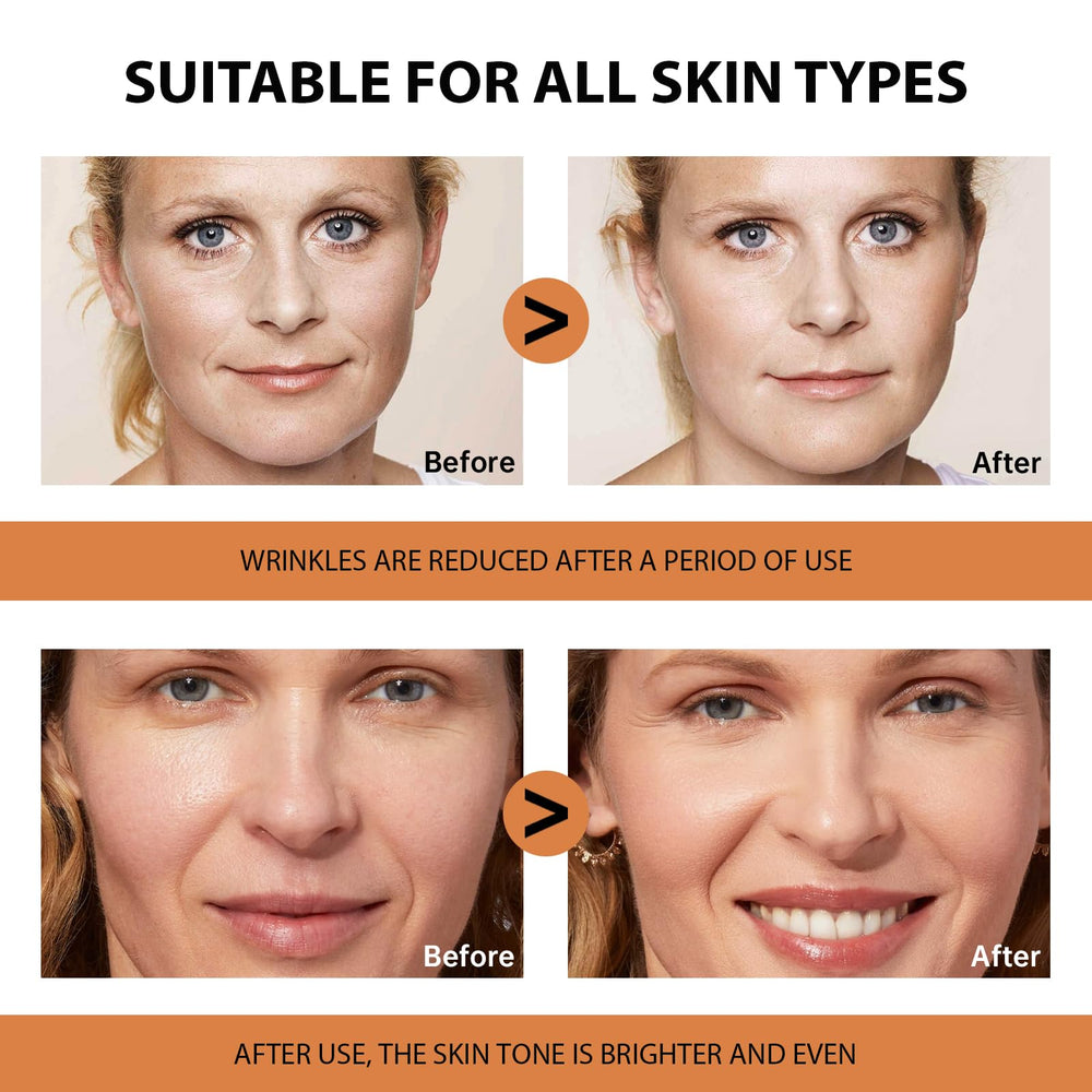 VGO ingredient list label showing vitamin C, hyaluronic acid benefits