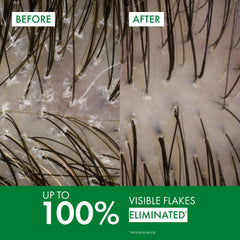 VICHY Dercos foam texture close-up demonstrating gentle lather
