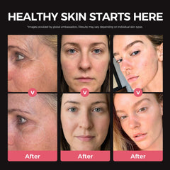 Viconor jawline contour demo showing smoother application and comfort