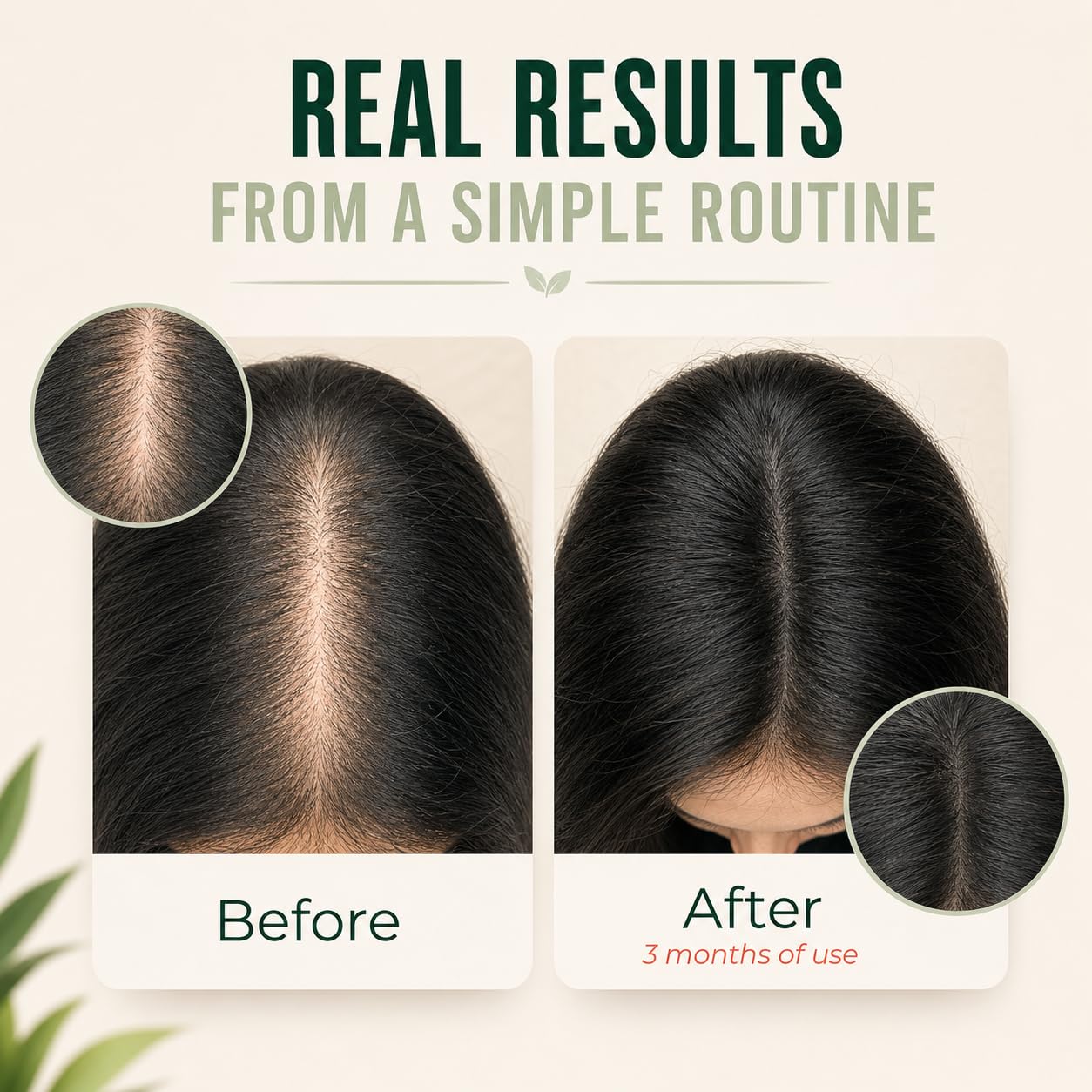 Vitamo Batana applied to scalp promoting targeted nourishment