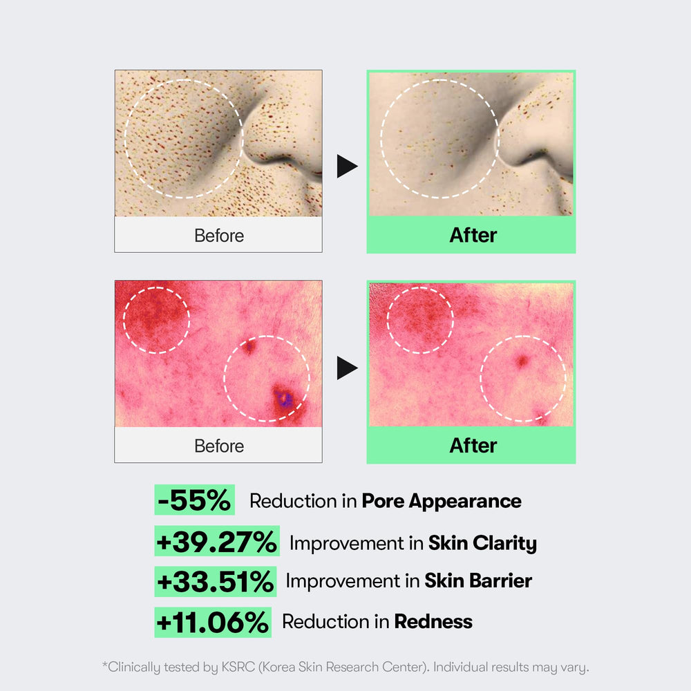 VT COSMETICS applying serum to cheek to show smoothing and pore benefit