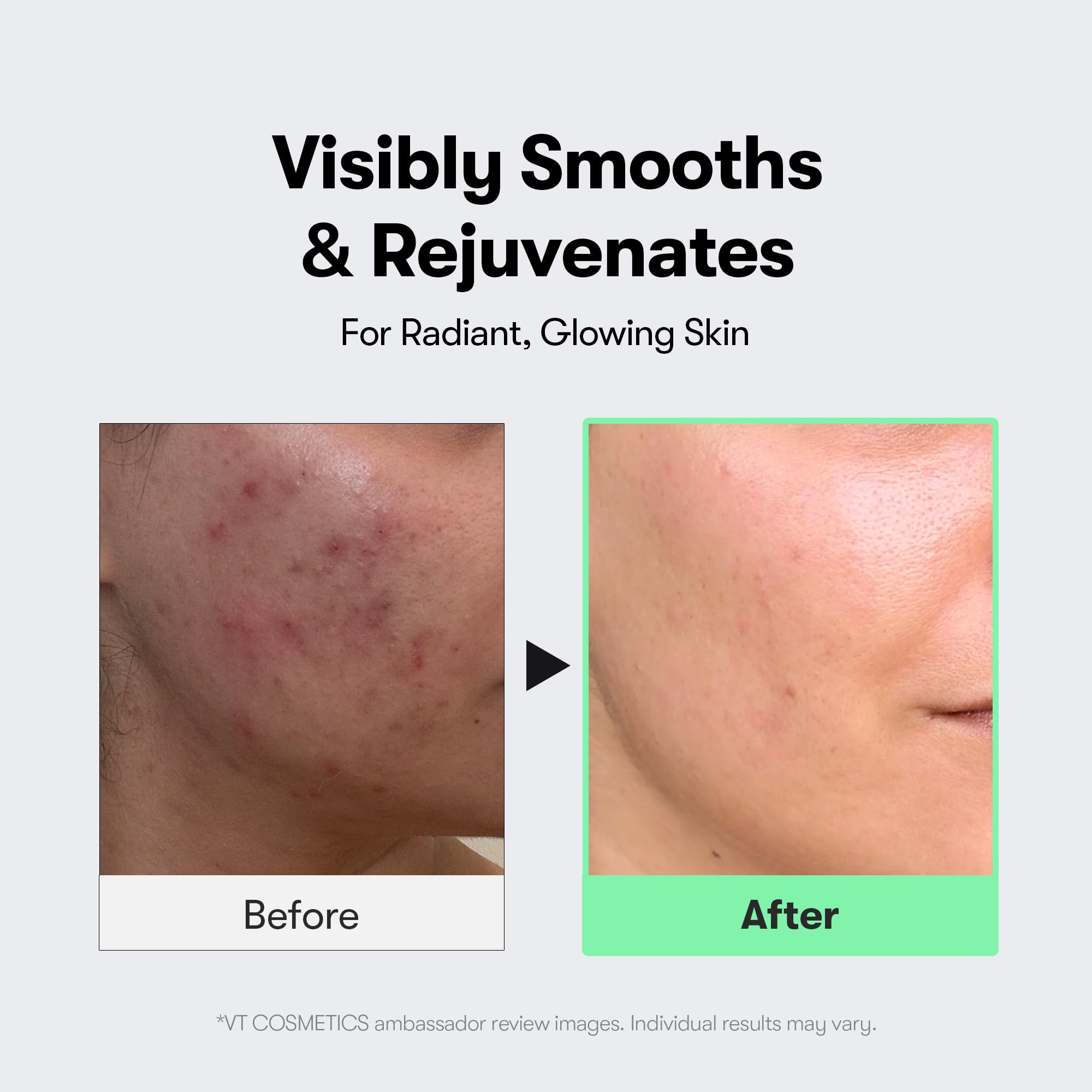 VT COSMETICS serum on fingertip illustrating lightweight absorption benefit