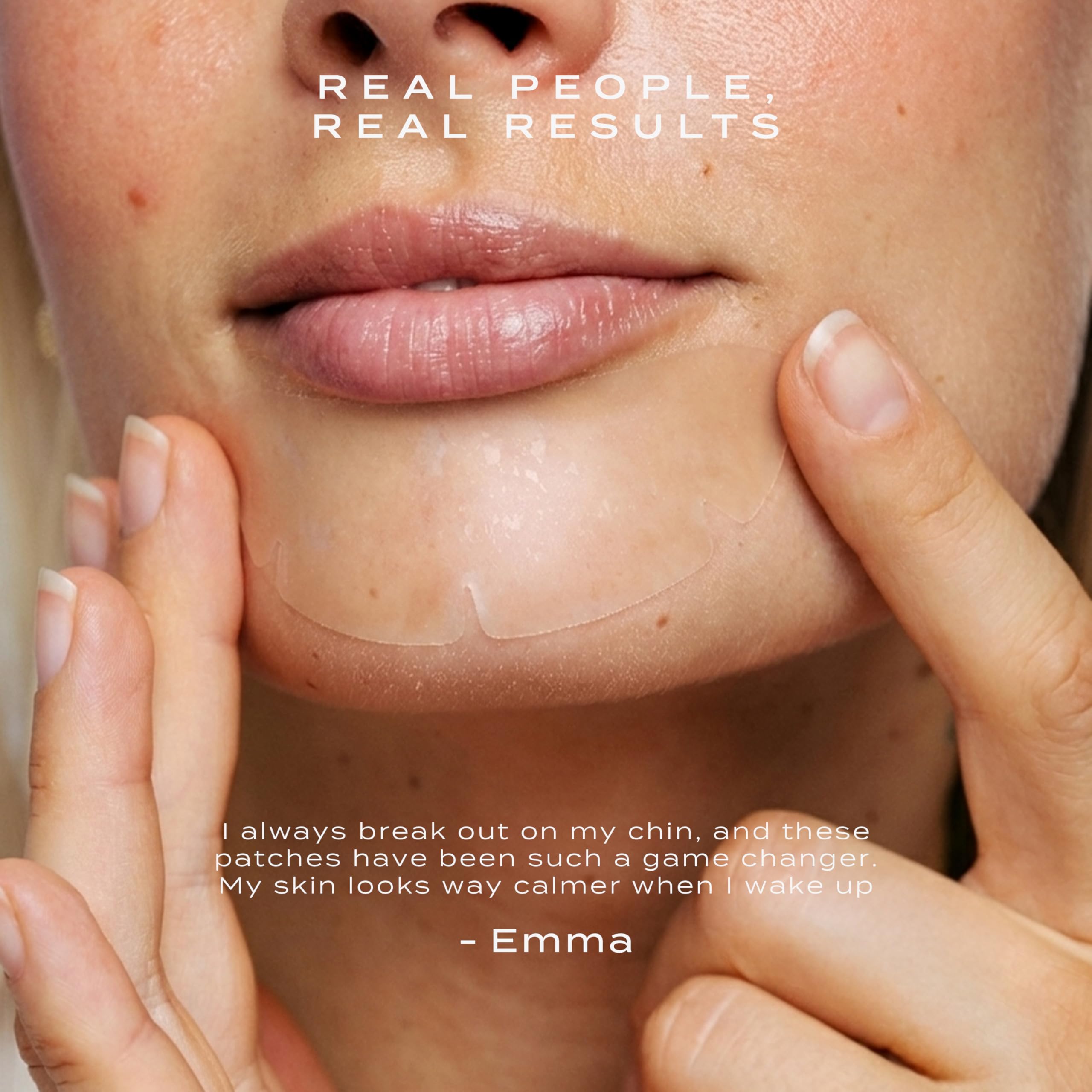 Vue patch applied to chin, demonstrating secure overnight adhesion and coverage