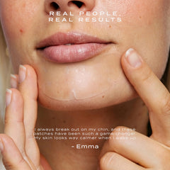 Vue patch applied to chin, demonstrating secure overnight adhesion and coverage