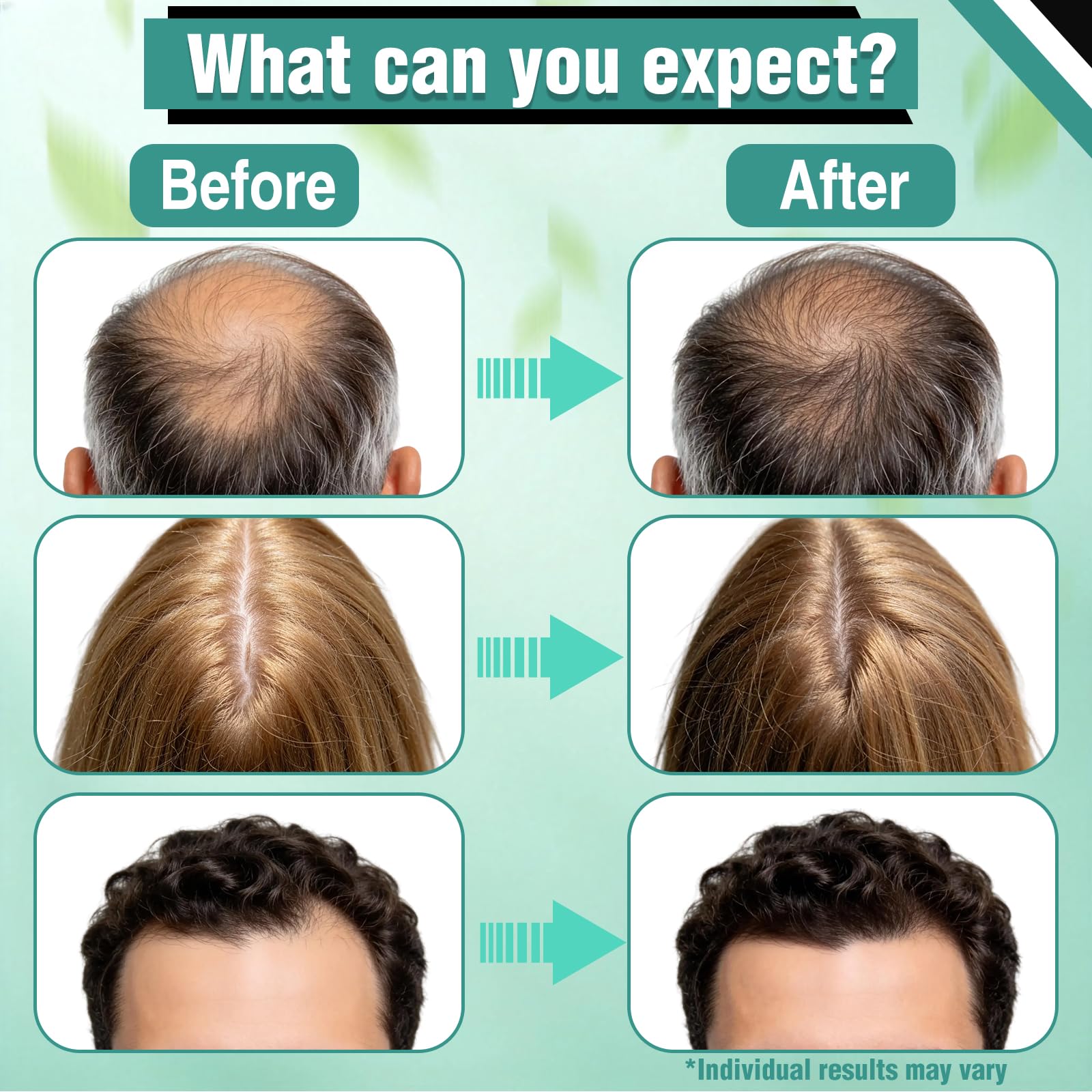 Wachinas application on scalp demonstration showing targeted placement benefits