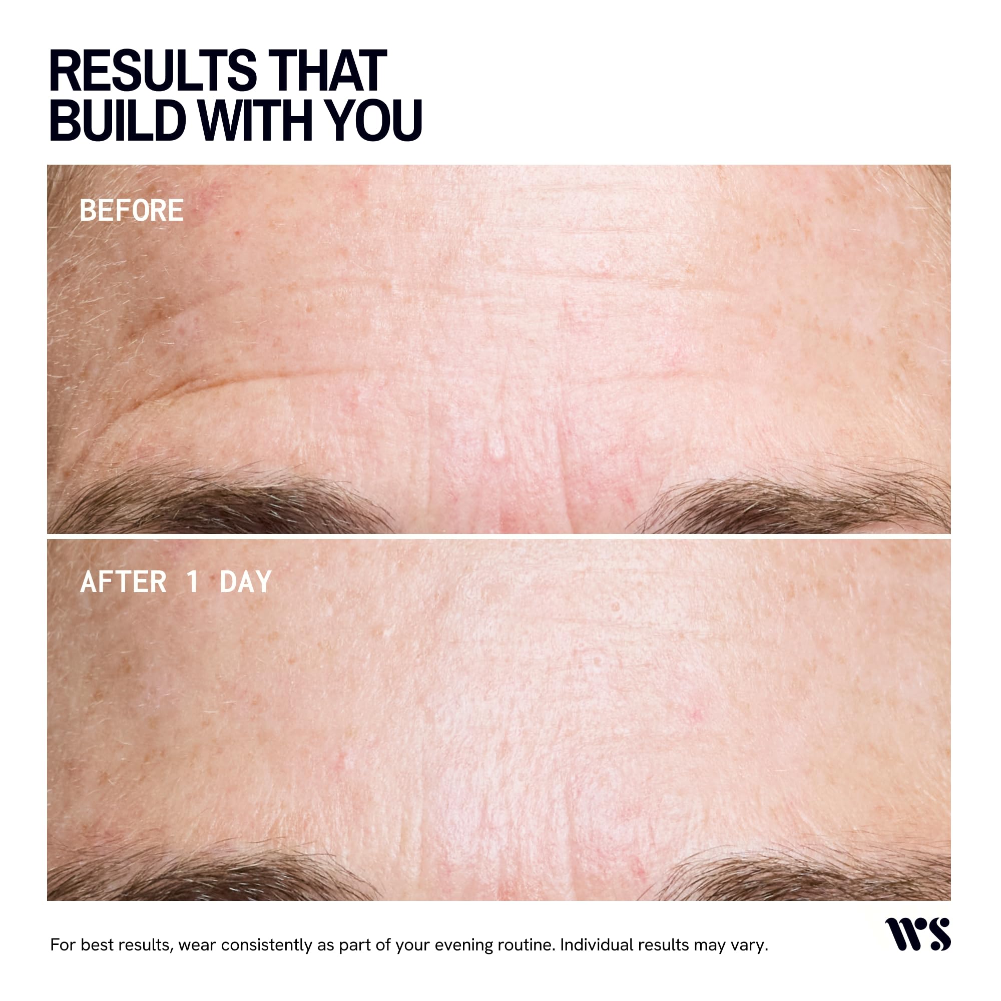 Wrinkles Schminkles close-up of silicone texture highlighting medical-grade material and gentle contact