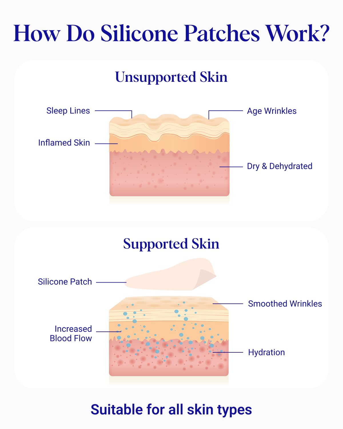 Wrinkles Schminkles side profile before and after showing visible smoothing
