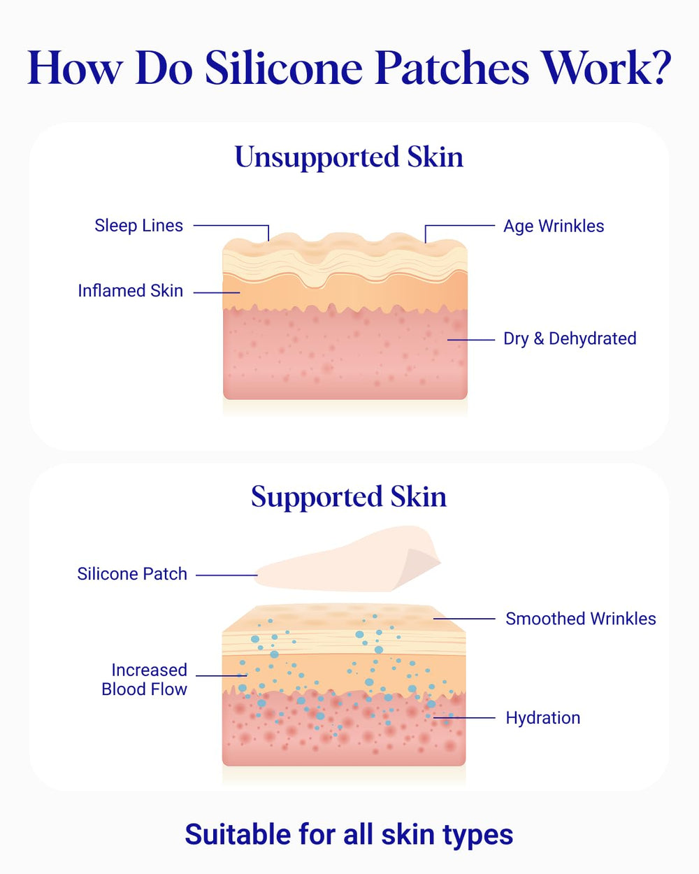 Wrinkles Schminkles side profile before and after showing visible smoothing