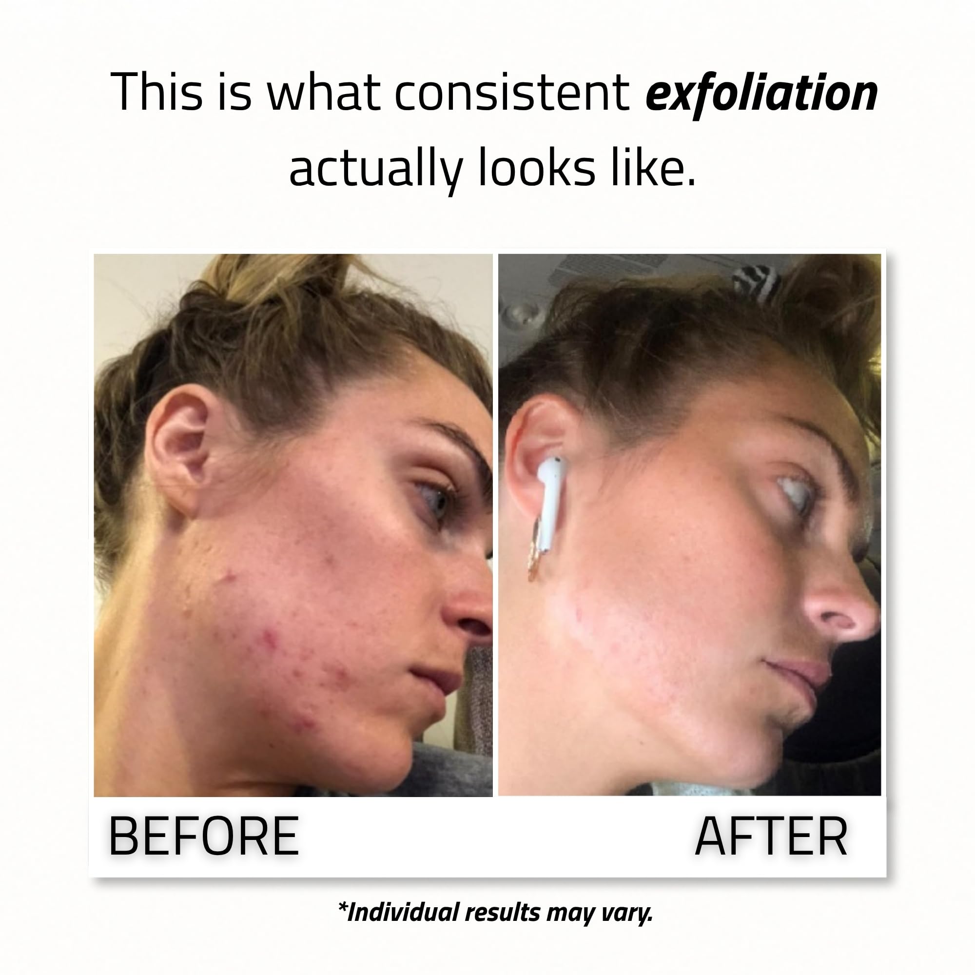 YEOUTH 1oz size in hand illustrating compact bottle for travel convenience