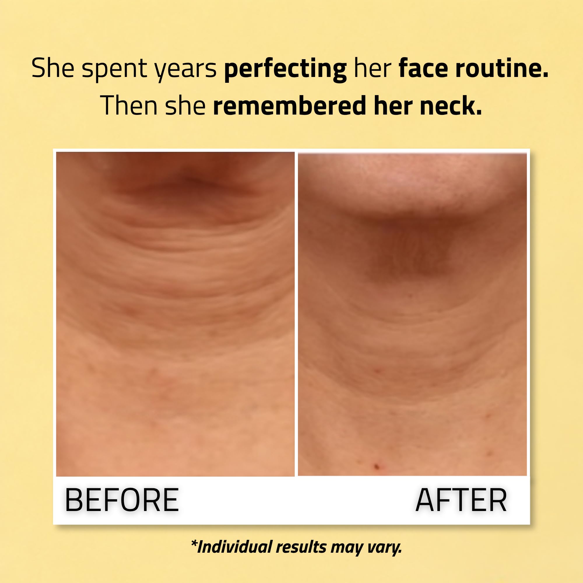 YEOUTH Vitamin C ingredient close-up highlighting brightening support