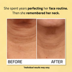 YEOUTH Vitamin C ingredient close-up highlighting brightening support