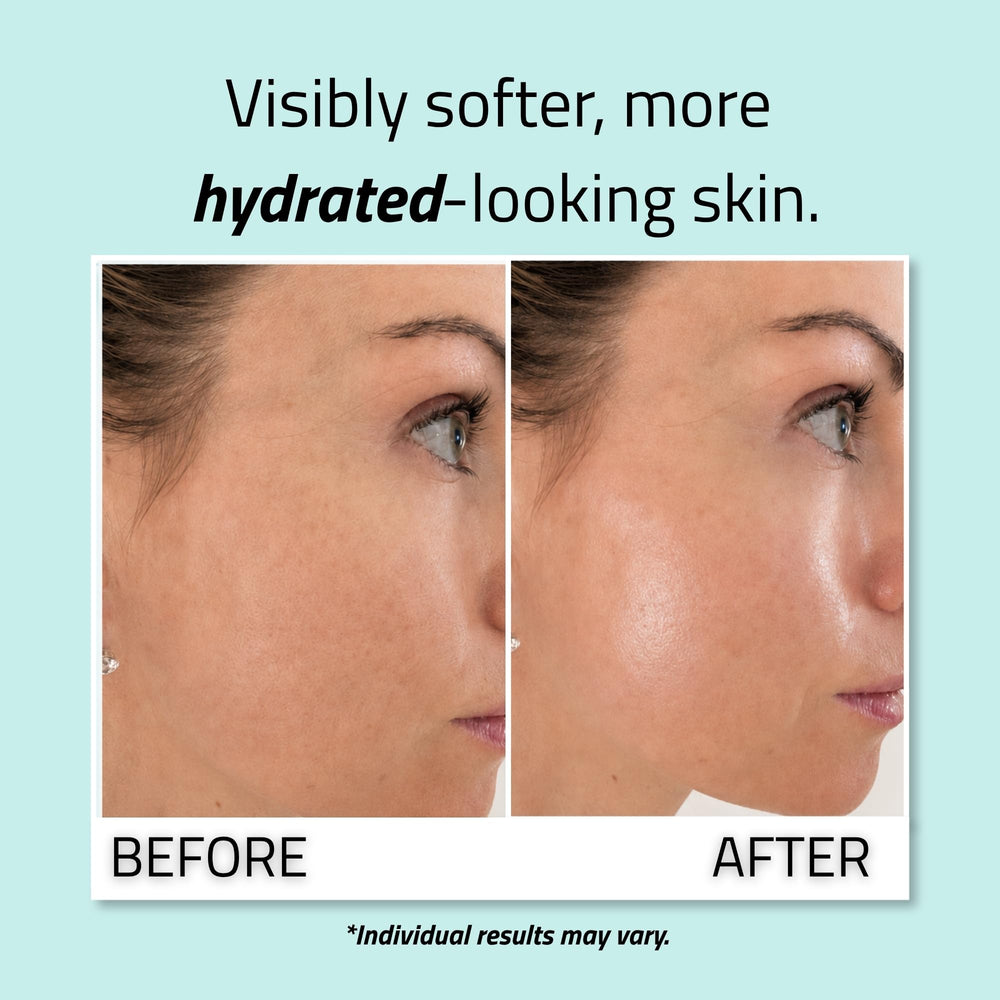 YEOUTH pipette releasing a drop illustrating concentrated hyaluronic hydration benefit