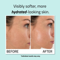 YEOUTH pipette releasing a drop illustrating concentrated hyaluronic hydration benefit