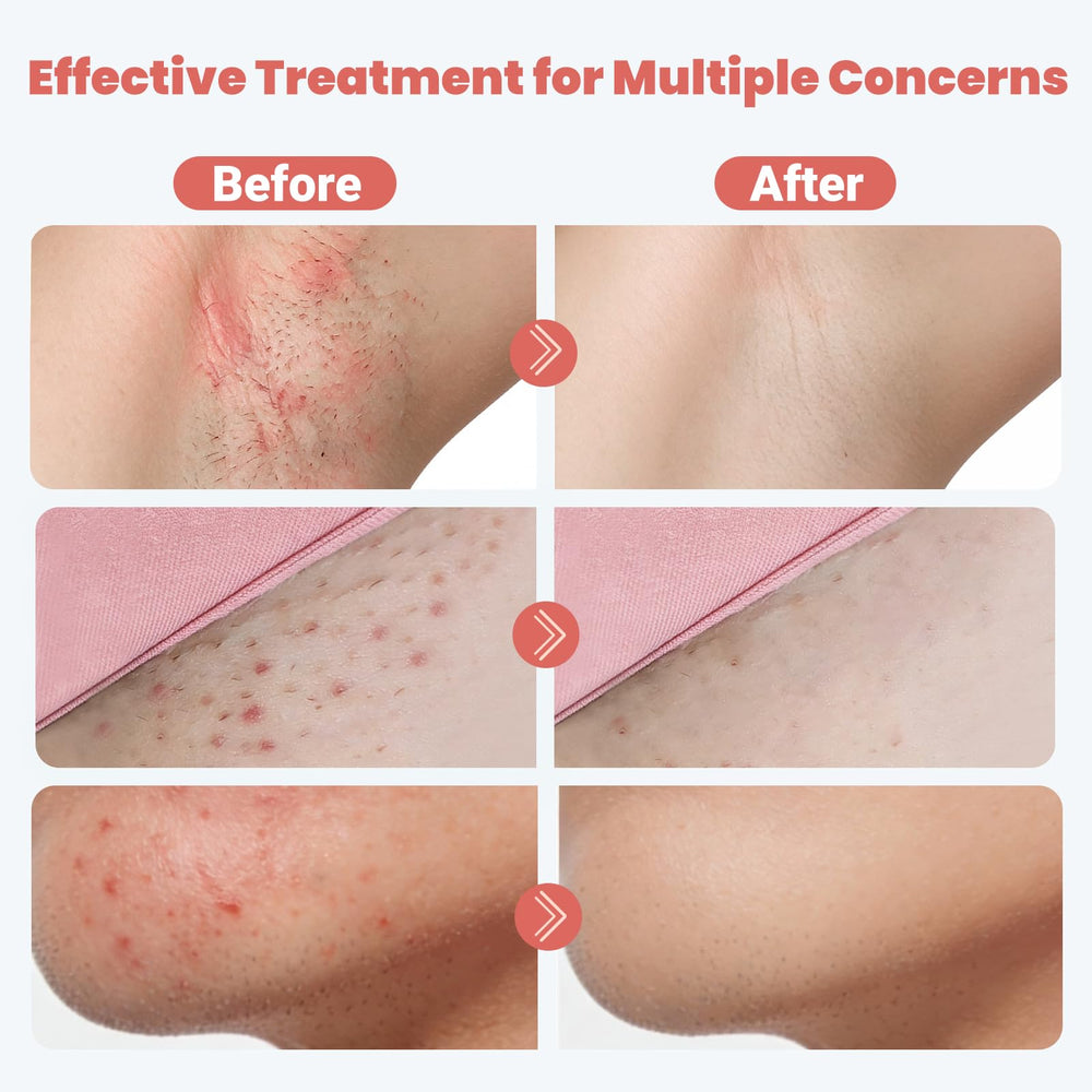 yimimde pad soaked with solution showing hydrating and calming formula