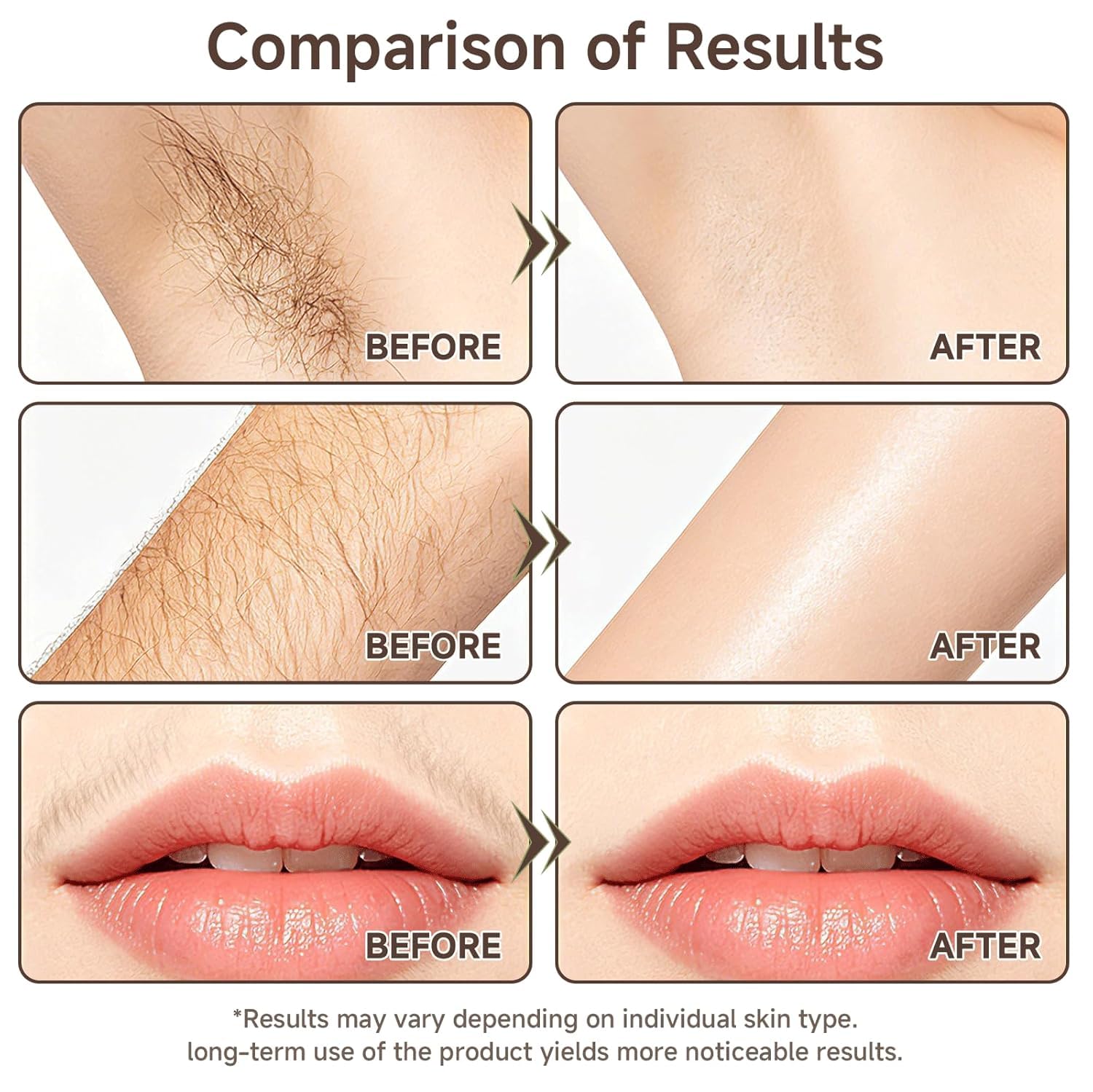YXYoupin before and after texture comparison showing refined pores and smoother-looking skin benefit