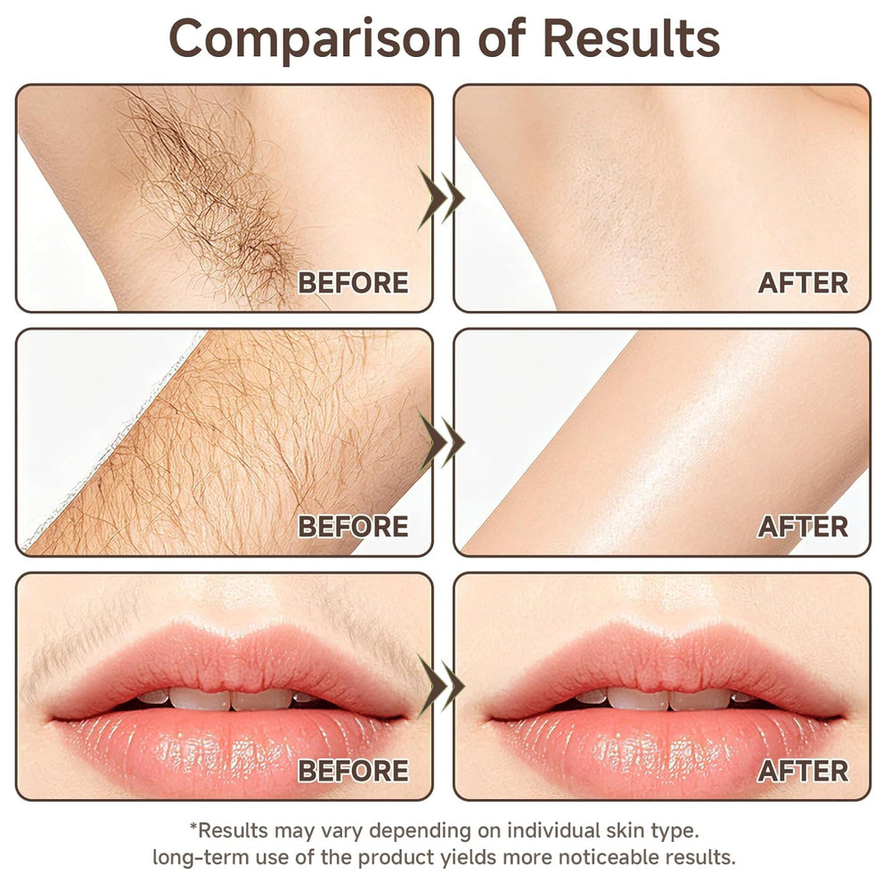 YXYoupin before and after texture comparison showing refined pores and smoother-looking skin benefit