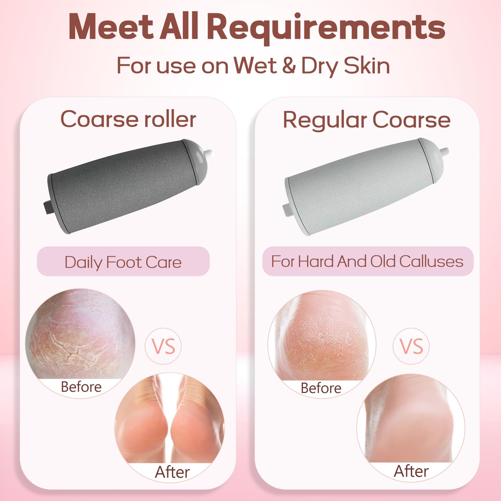 ZABOUL in use on heel showing gentle callus removal for smoother skin