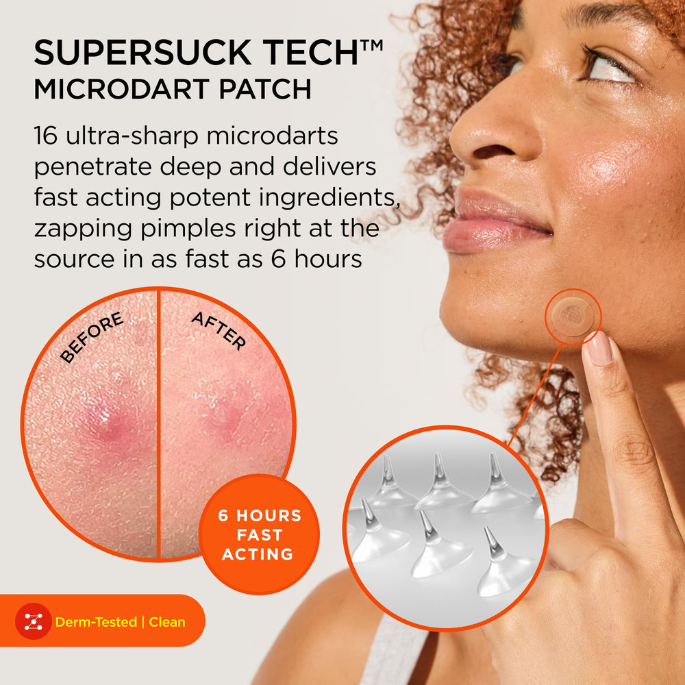 ZitSticka close-up of microdarts dissolving to deliver actives quickly