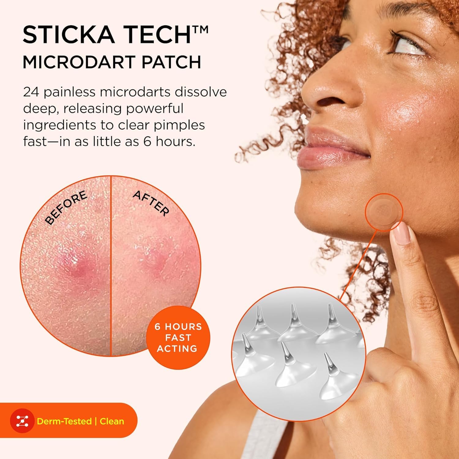ZitSticka priming swab beside a KILLA patch for clean application
