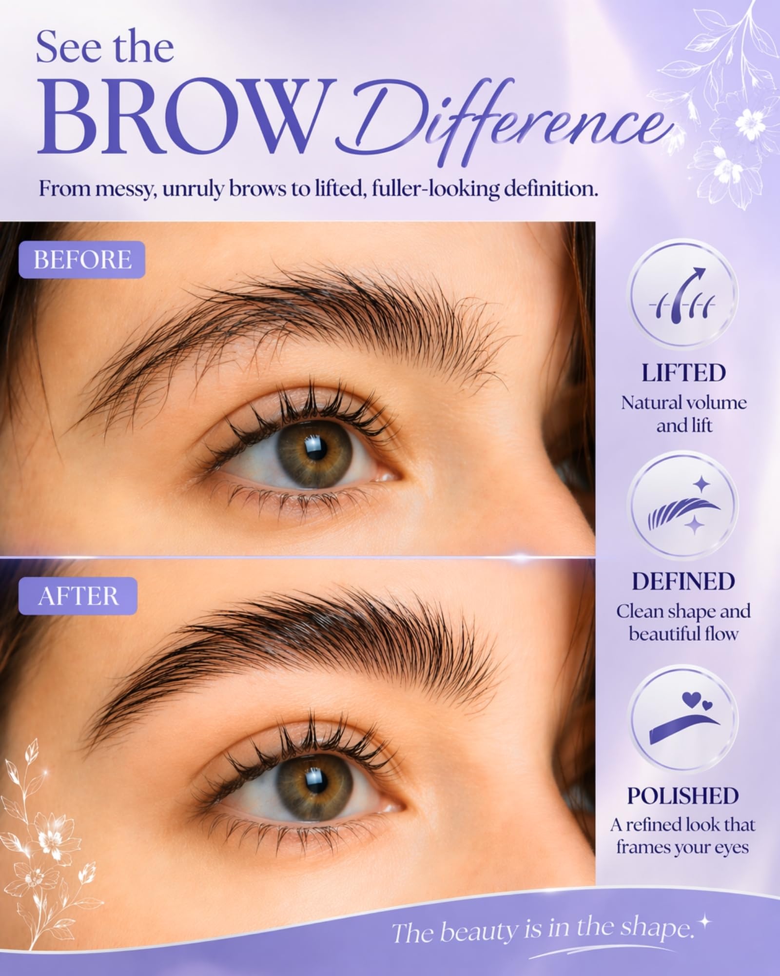 Zovica single-use sachets lined up to ensure fresh, premeasured application